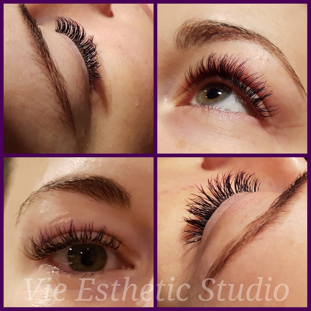 Vie Esthetic Studio | 2374 Rondel St, Gloucester, ON K1B 4M2, Canada | Phone: (613) 724-1311