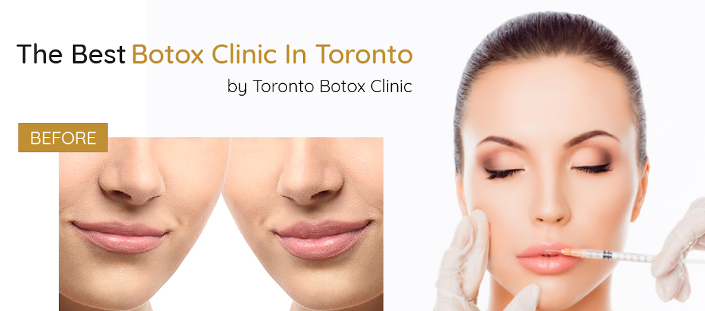 Botox Toronto Clinic | 249 Queens Quay W #112, Toronto, ON M5J 2N5, Canada | Phone: (905) 487-0620