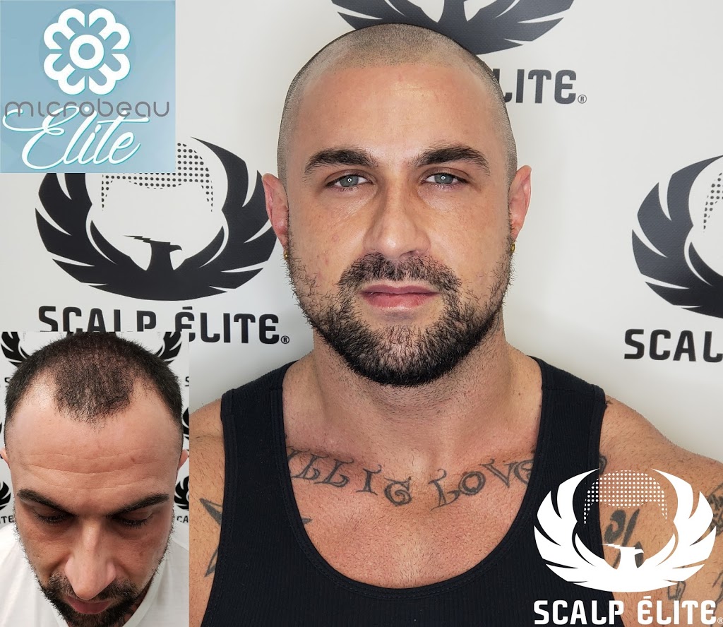 Clinical Scalp Élite© Certifiée | 2700 Boulevard des Entreprises #102, Terrebonne, QC J6X 4J8, Canada | Phone: (877) 439-5554