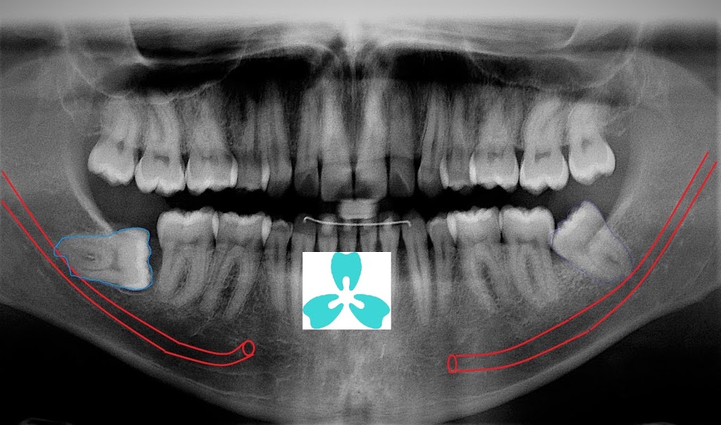 PleasantView Family Dental - Dr. Ross Tam Dr. Michael Chan Dr. C | 2772 Victoria Park Ave Suite 201, North York, ON M2J 4A8, Canada | Phone: (416) 491-6262