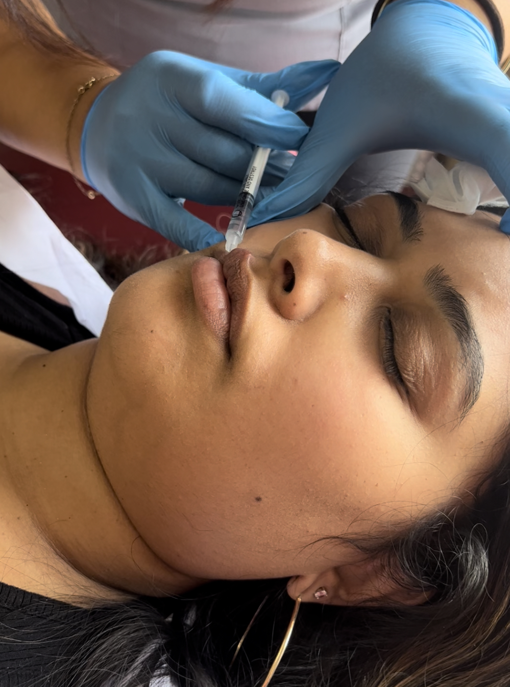 Beauty Injectables | 44 Daleridge Crescent, Brampton, ON L6P 2X8, Canada | Phone: (416) 276-7203