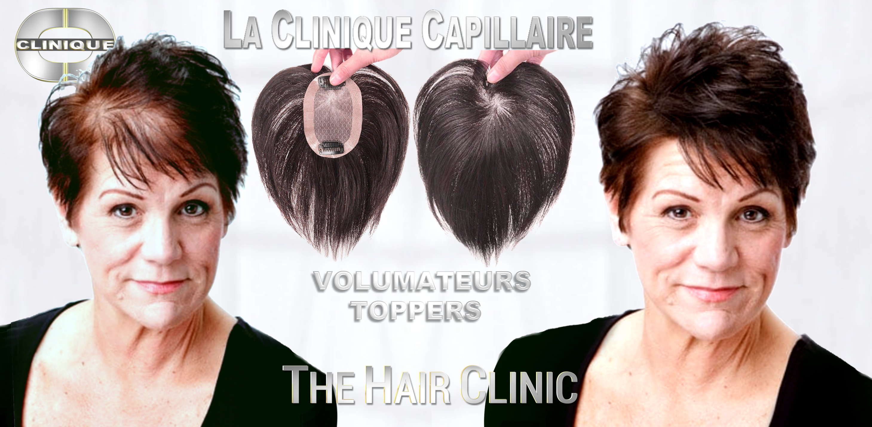 La Clinique Capillaire - The Hair Clinic | 2070 Crescent St, Montreal, Quebec H3G 2B8, Canada | Phone: (514) 848-6185