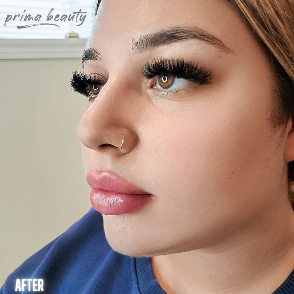 Prima Beauty Aesthetics | 4284 Owl Valley Dr, Gloucester, ON K1V 1L8, Canada | Phone: (613) 709-6477