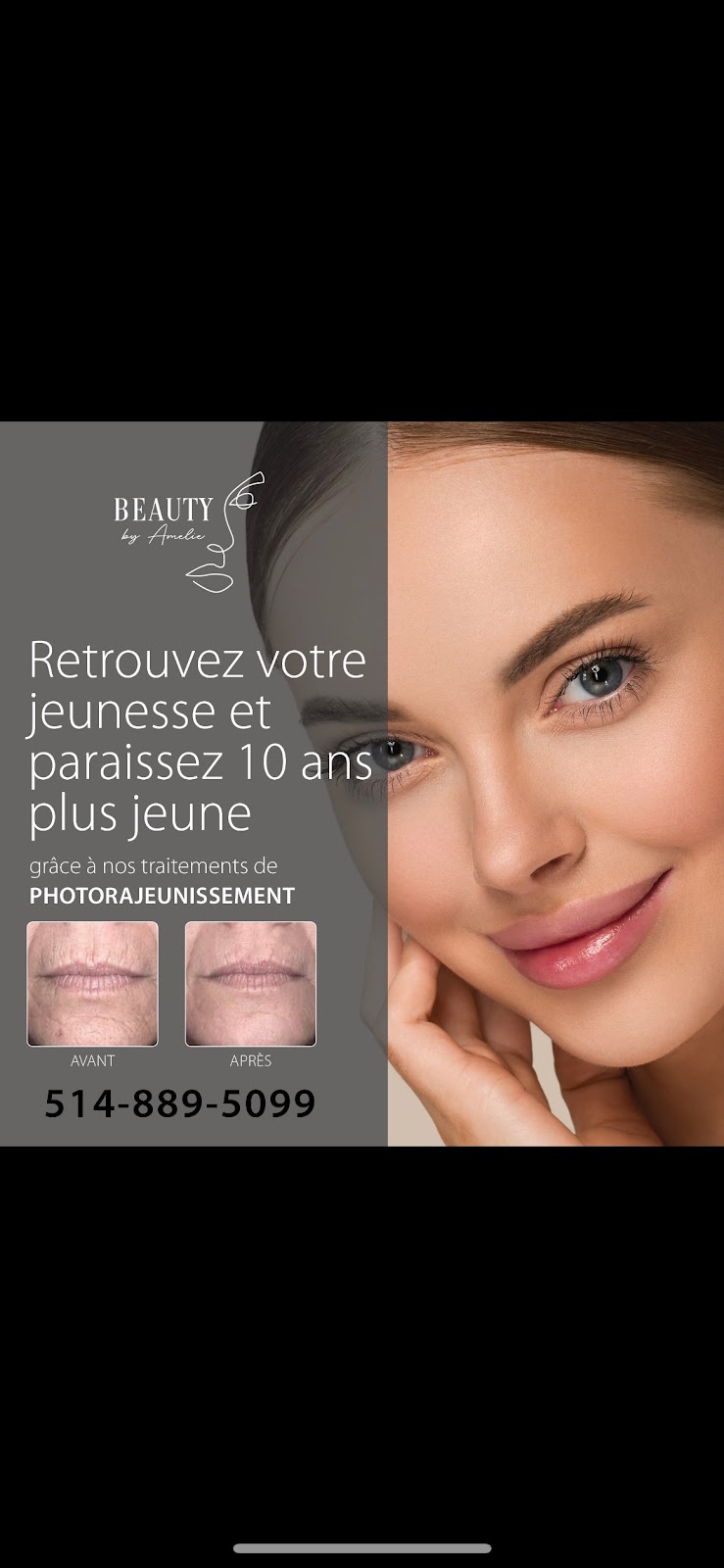 Beauty By Amelie Laser & Esthétique | Rue Victor, Mirabel, QC J7J 1B4, Canada | Phone: (514) 889-5099