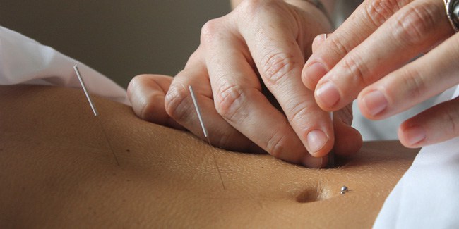 Amazing Hope Acupuncture Clinic | 401 Argyle St, Summerside, PE C1N 3S3, Canada | Phone: (902) 432-4927