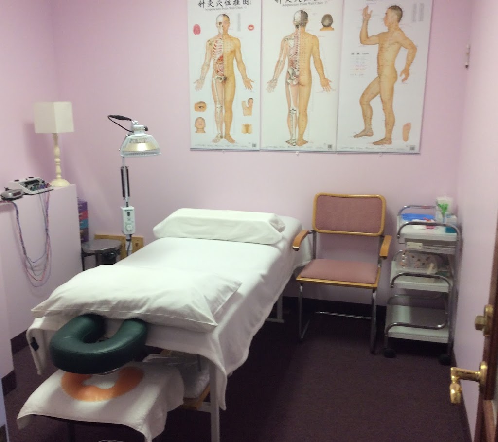 Acupuncture + Massage Clinic | 6633 Hwy 7 #316, Markham, ON L3P 7P2, Canada | Phone: (647) 760-7710