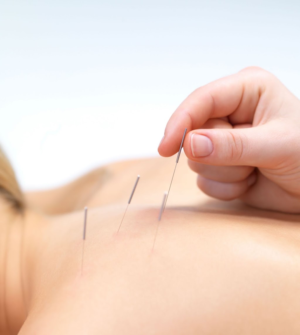 Amazing Hope Acupuncture Clinic | 401 Argyle St, Summerside, PE C1N 3S3, Canada | Phone: (902) 432-4927