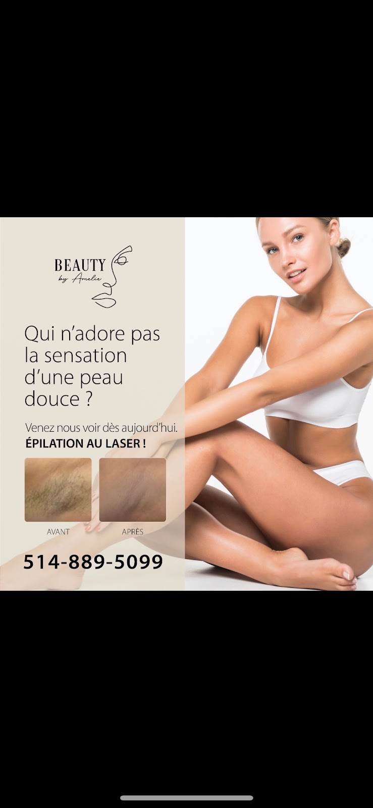 Beauty By Amelie Laser & Esthétique | Rue Victor, Mirabel, QC J7J 1B4, Canada | Phone: (514) 889-5099