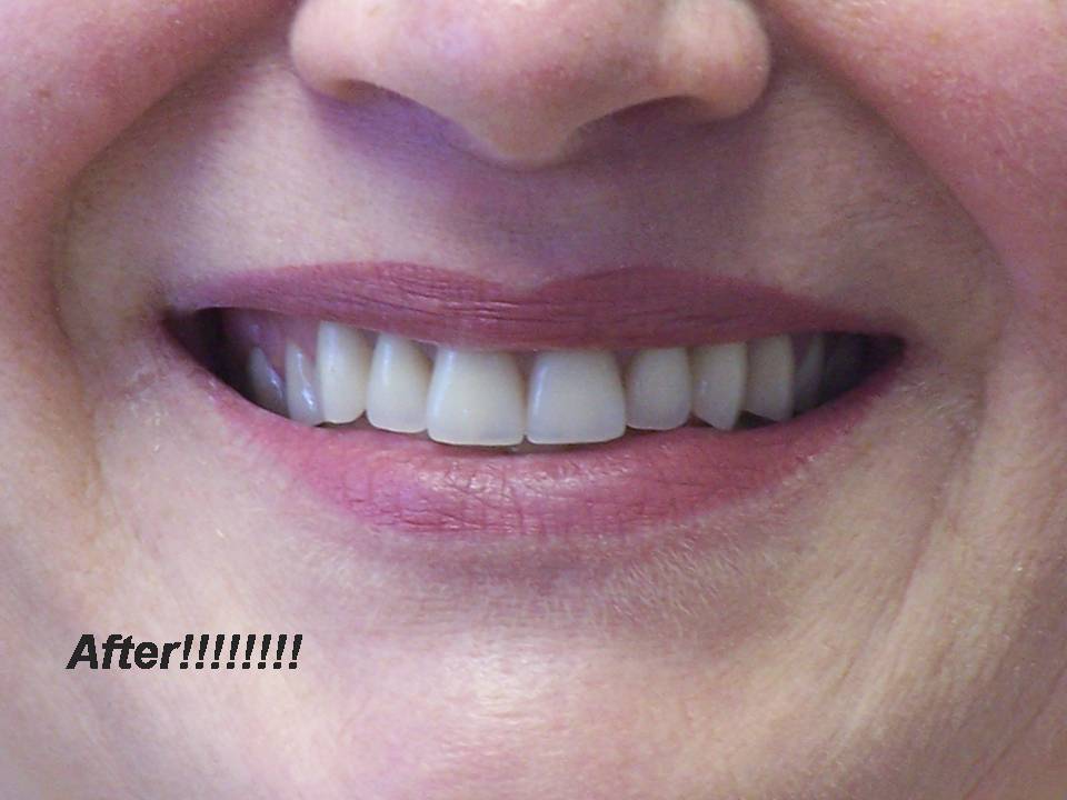 Central Park Denture Clinic | 1711 Cook St, Victoria, BC V8T 3P2, Canada | Phone: (250) 388-4100