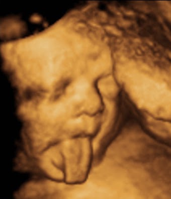 Babys Bungalow 3D & 4D Ultrasound Buffalo NY | 7293 Schultz Rd #1, North Tonawanda, NY 14120, USA | Phone: (716) 692-3343