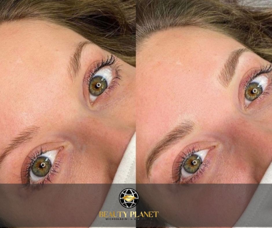 Beauty Planet Microblading & Aesthetics | 29 Golden Trail, Vaughan, ON L6A 5A1, Canada | Phone: (647) 241-6646