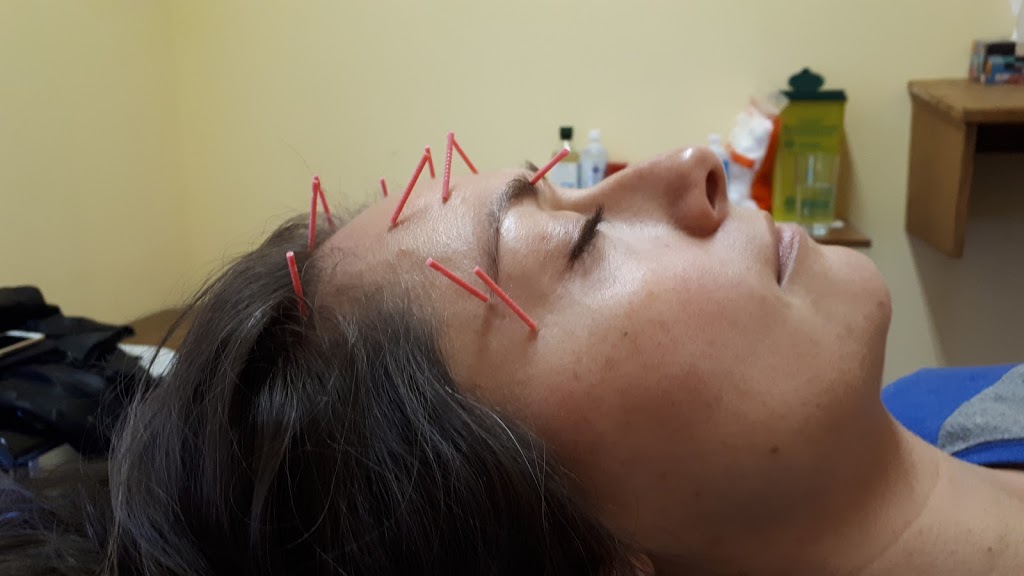 AcuFunkture - Registered Acupuncture in Nanaimo | 4488 Wellington Rd #2b, Nanaimo, BC V9S 5W8, Canada | Phone: (236) 238-1806