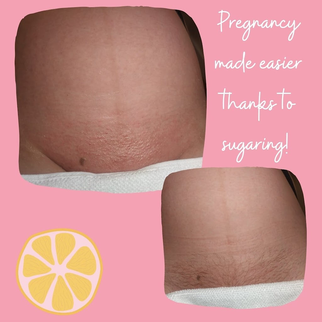 The Cheeky Lemon Body Sugaring + Nails | 3767 56 Ave E, Edmonton International Airport, AB T9E 0V4, Canada | Phone: (587) 709-1232