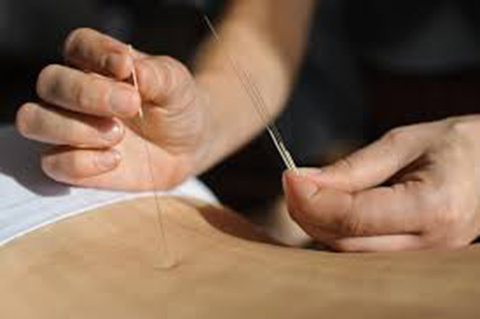 Acupuncture Audrey Valade | 450 Boulevard Brassard #204, Chambly, QC J3L 6K4, Canada | Phone: (450) 279-1112