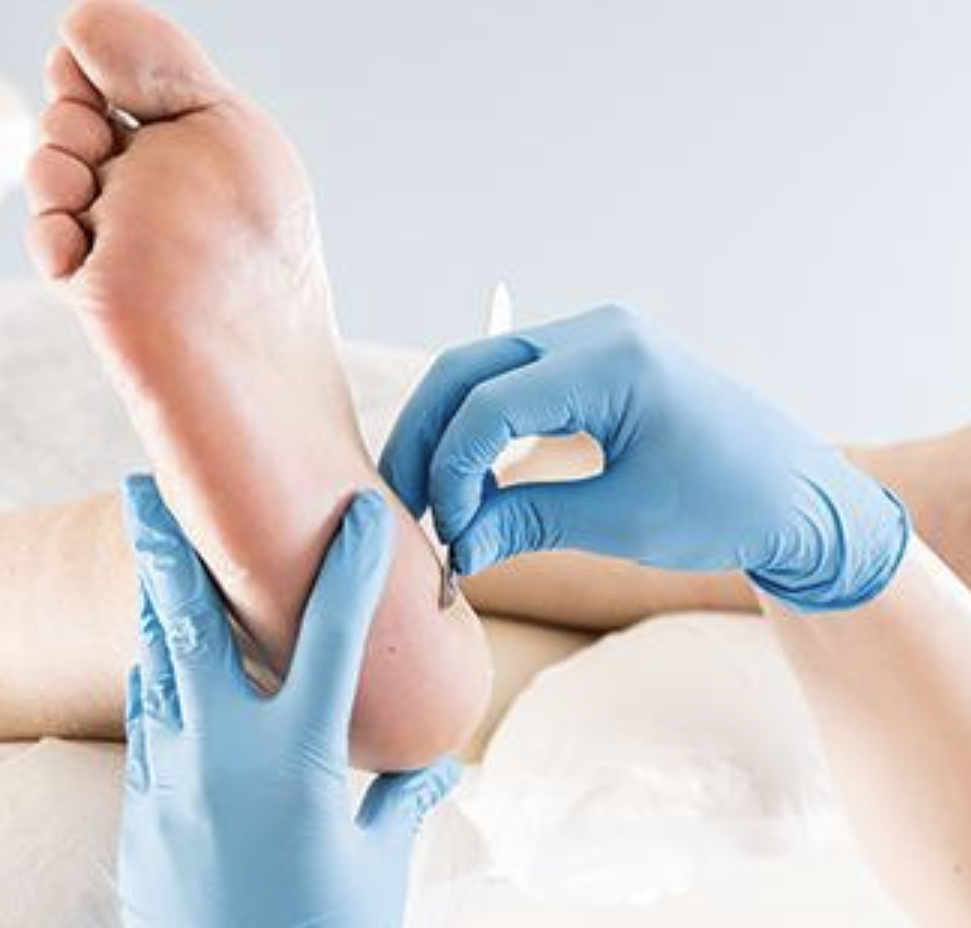 Clinique de soins de pieds/soins infirmiers Beauport | 202 Avenue St Michel, Québec, QC G1C 1G1, Canada | Phone: (418) 265-9447