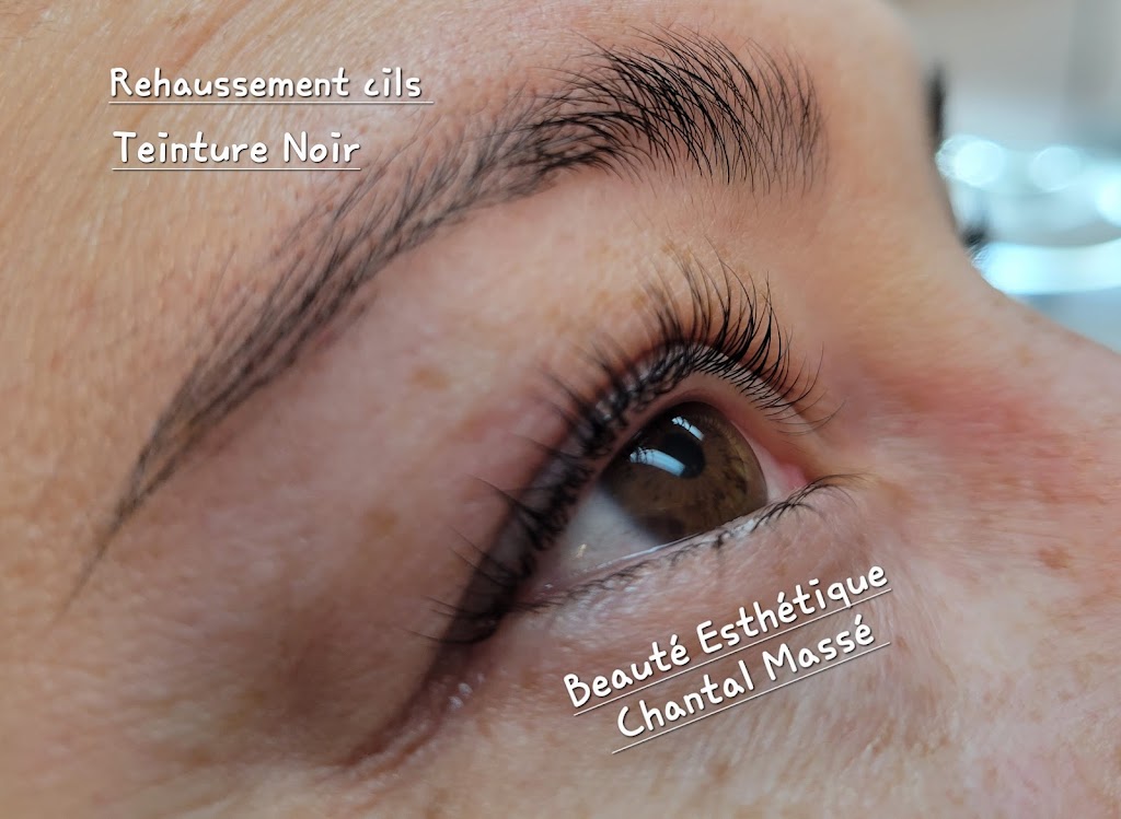 Beaute Esthetique Chantal | 295 A Bd Gagné, Sorel-Tracy, QC J3P 5X3, Canada | Phone: (450) 743-3421