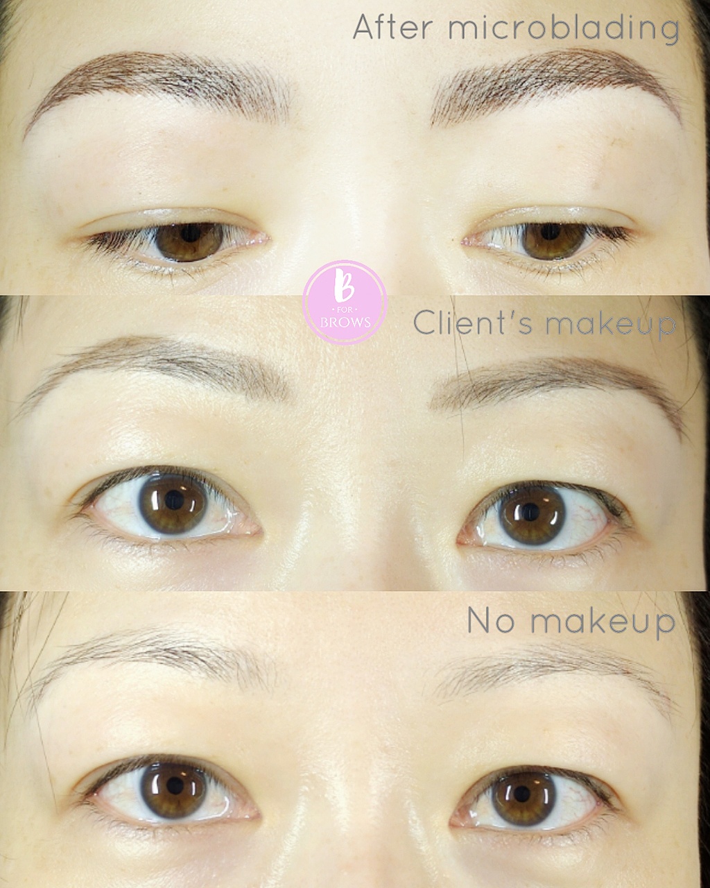 Microblading Eyebrows Vancouver by B for Brows | 4889 Slocan St, Vancouver, BC V5R 2A2, Canada | Phone: (604) 715-2846