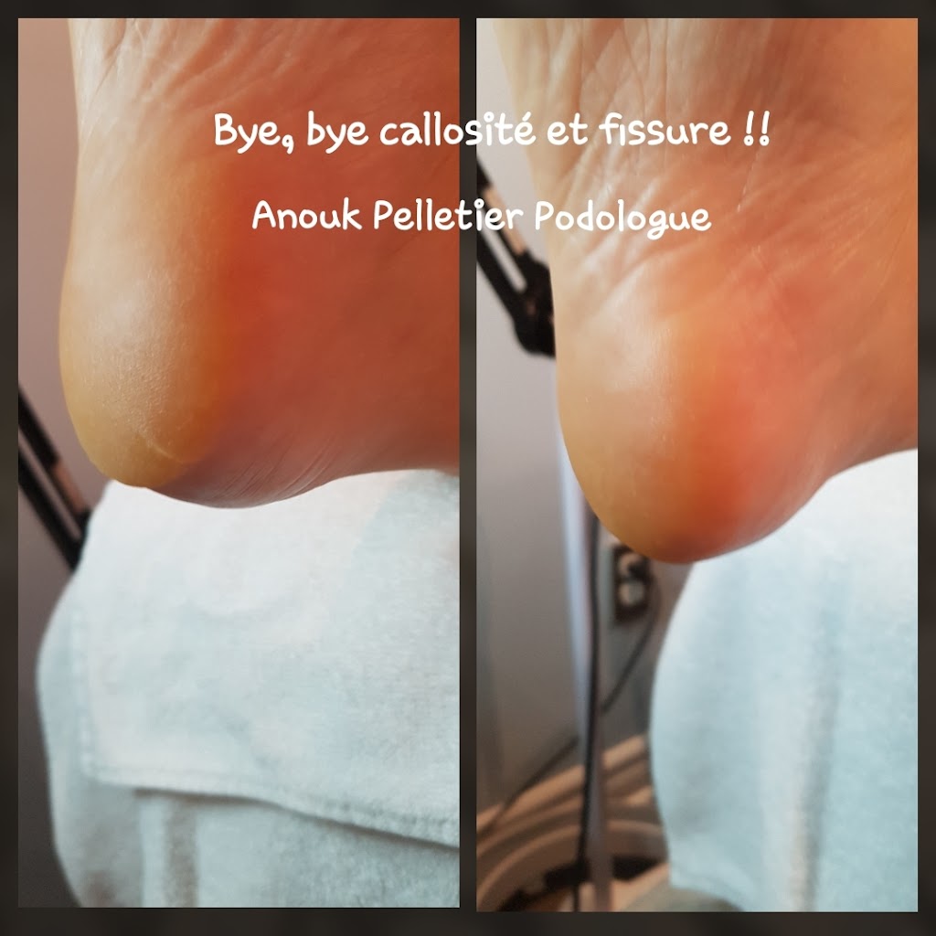 Anouk Pelletier podologue | 5035 Boulevard des Laurentides, Laval, QC H7K 2J7, Canada | Phone: (514) 756-6737