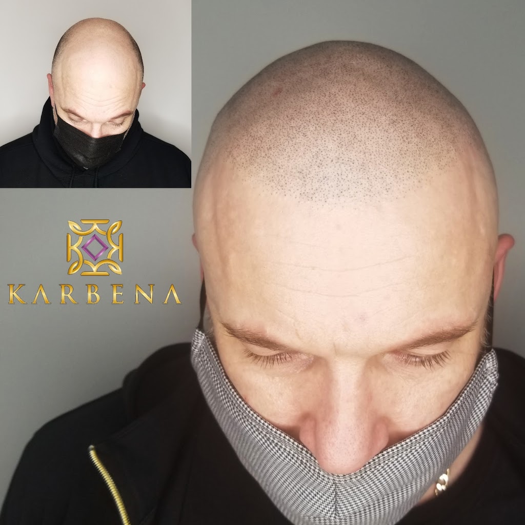 Karbena Scalp Micropigmentation | 22714 Dewdney Trunk Rd Suite 102, Maple Ridge, BC V2X 3K2, Canada | Phone: (778) 241-2433