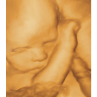 3D BabyVision-3D Ultrasound Mississauga (Square One) | 4299 Village Centre Ct, Mississauga, ON L4Z 1S2, Canada | Phone: (905) 337-9555