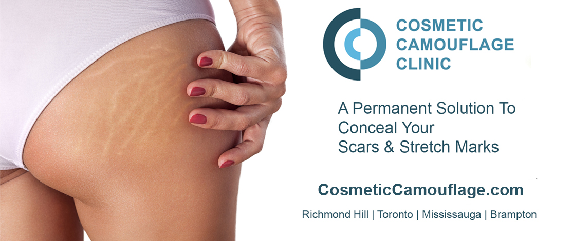 Laser Wellness & Trichology Centre | 9140 Leslie St #301, Richmond Hill, ON L4B 3L6, Canada | Phone: (647) 697-6450