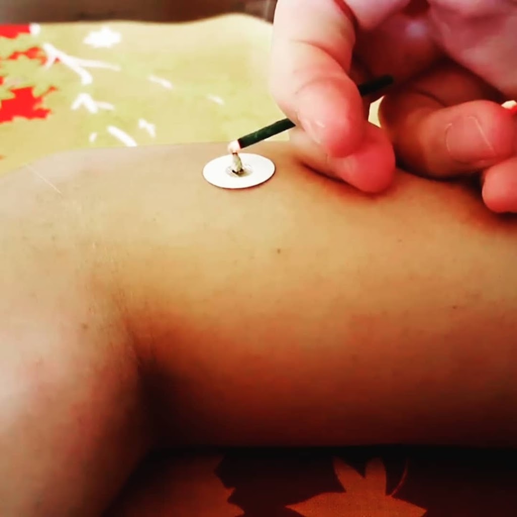 Takeya Japanese Acupuncture | 225 Spinnaker Dr, Halifax, NS B3N 3C3, Canada | Phone: (902) 412-3393