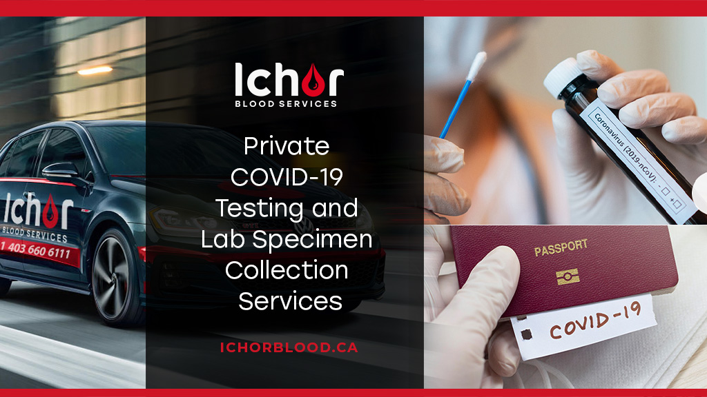 Ichor Blood Services | 7777 10 St NE Suite 100, Calgary, AB T2E 8X2, Canada | Phone: (844) 424-6728