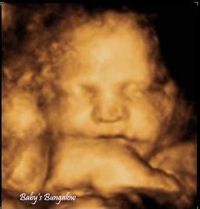 Babys Bungalow 3D & 4D Ultrasound Buffalo NY | 7293 Schultz Rd #1, North Tonawanda, NY 14120, USA | Phone: (716) 692-3343