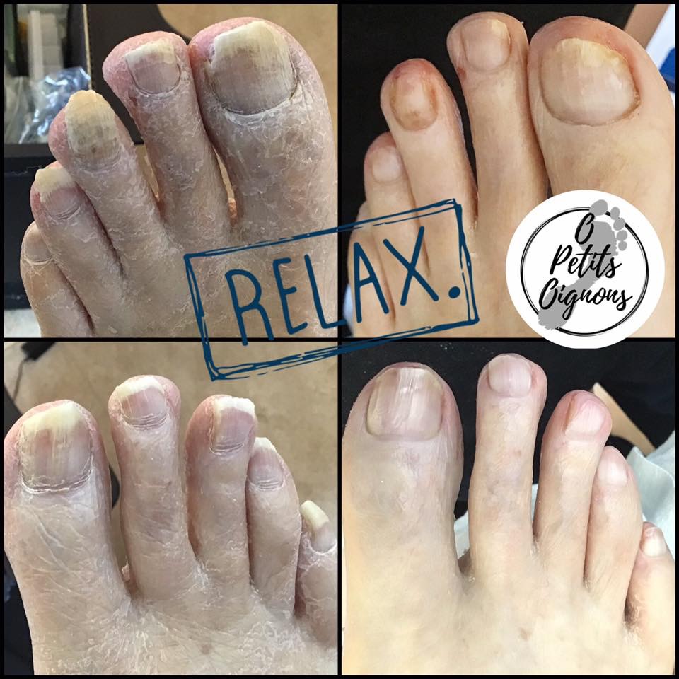 soins des pieds O petits oignons | 49 Rue du Hauban, Oka, QC J0N 1E0, Canada | Phone: (514) 627-8408