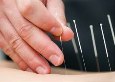 BodyTx - Massage | Acupuncture | Naturopathy | 8741 84 St #105, Fort Saskatchewan, AB T8L 0M3, Canada | Phone: (587) 285-4411