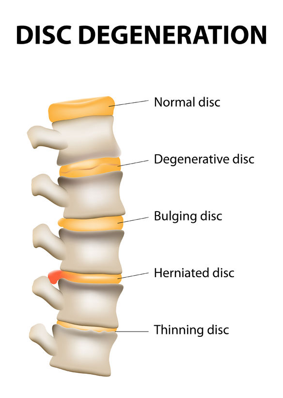 Vellore Chiropractic & Wellness Centre | 9587 Weston Rd #7, Woodbridge, ON L4H 3A5, Canada | Phone: (905) 417-5272