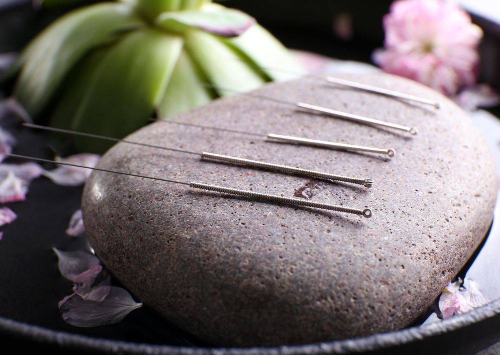 The Healing Hearth Acupuncture & Herbal Medicine | 7159 W Saanich Rd, Brentwood Bay, BC V8M 1P7, Canada | Phone: (778) 679-6890