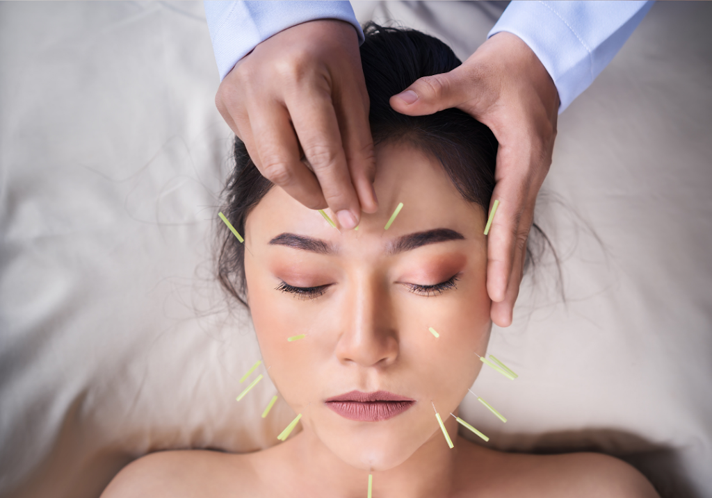 Balance To Heal Acupuncture | 304 Cranberry Park SE unit 202, Calgary, AB T3M 1W2, Canada | Phone: (705) 500-6601