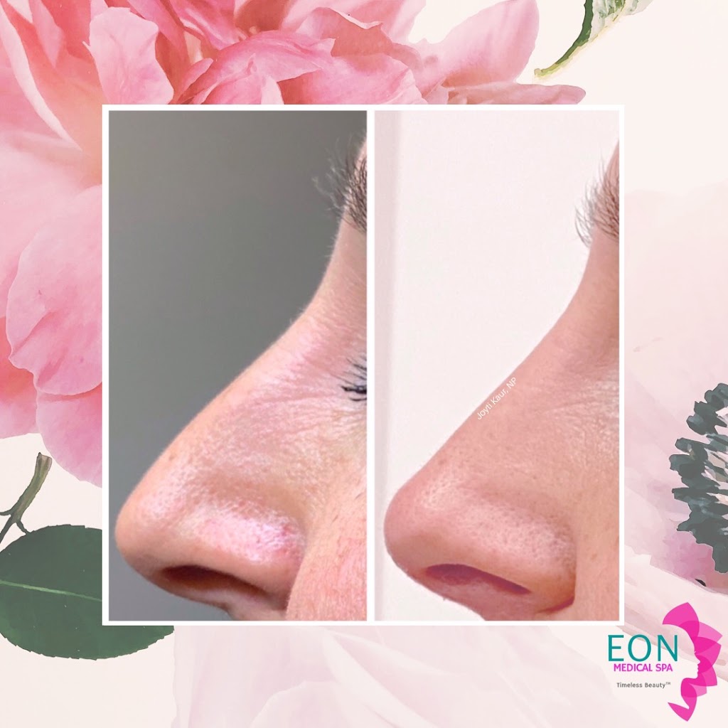 Eon Medical Spa | 8655 Weston Rd, Woodbridge, ON L4L 9R6, Canada | Phone: (416) 723-5553