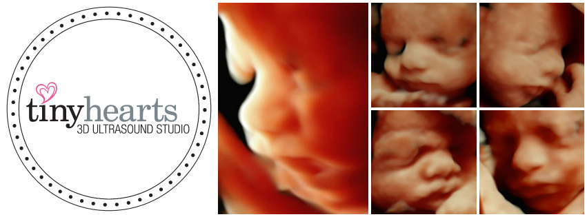Tiny Hearts 3D Ultrasound Studio | 2525 Old Bronte Rd #455, Oakville, ON L6M 4J2, Canada | Phone: (905) 465-3343