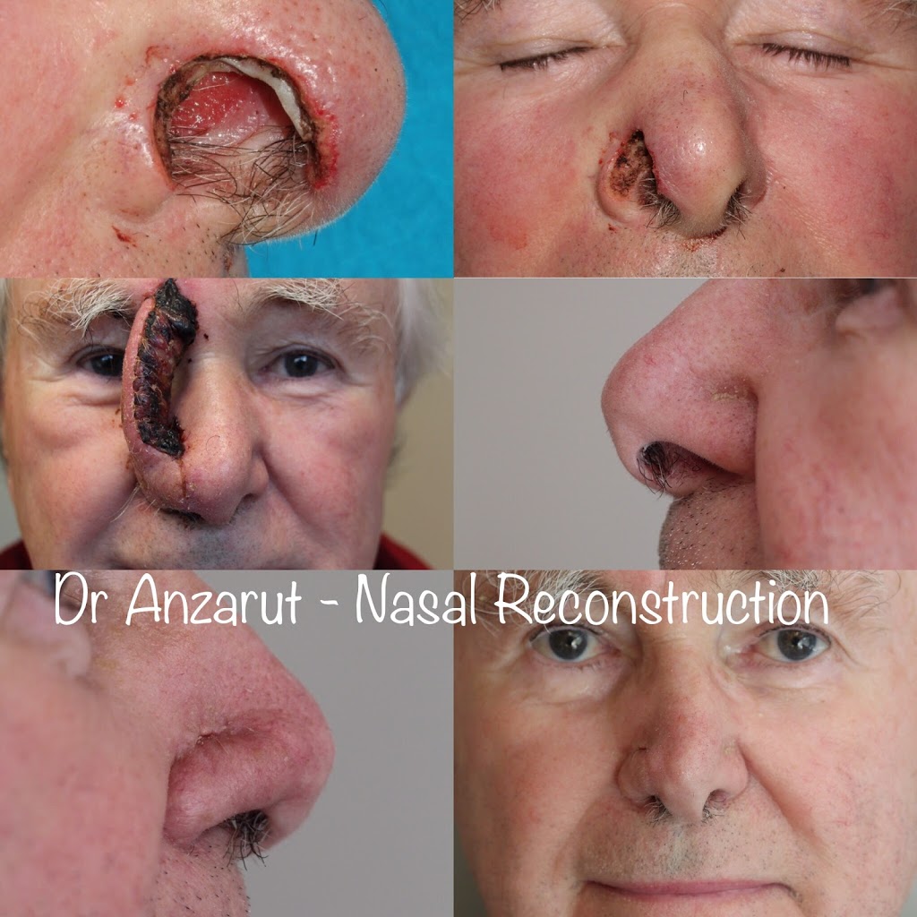 Dr Anzarut Plastic Surgery | 2763 Beverly St Suite 201b, Duncan, BC V9L 6X2, Canada | Phone: (250) 597-2064