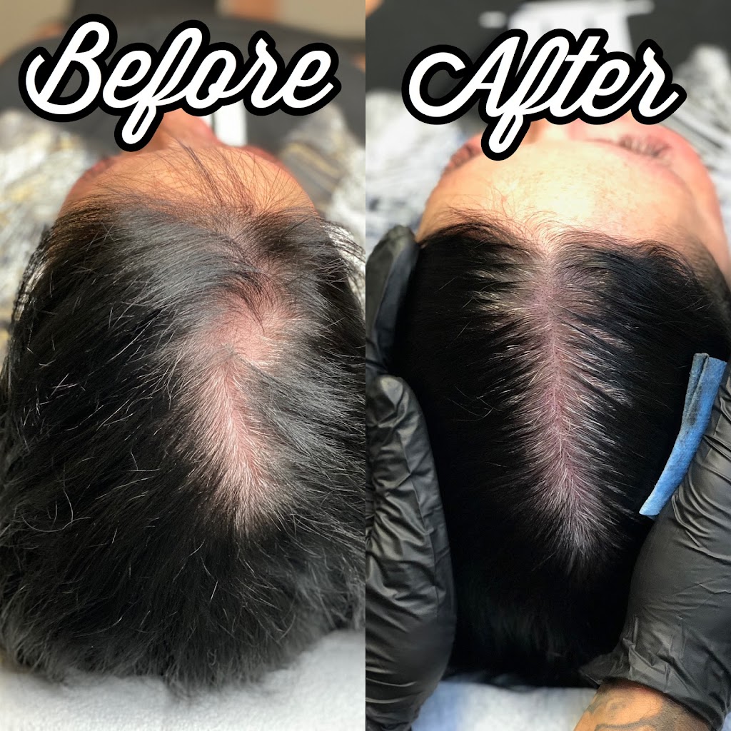 Scalp Collective - Micropigmentation | 7004 Macleod Trail Unit #117, Calgary, AB T2H 0L3, Canada | Phone: (403) 813-9282