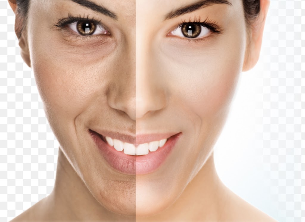 Allure Medical Aesthetics | 79 Rymal Rd W, Hamilton, ON L9B 1B5, Canada | Phone: (289) 389-8800