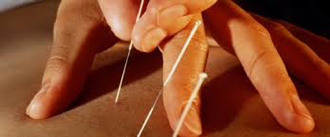 Acupuncture Marie-Pier Racine - Prévost _ | 2943 Boulevard du Curé-Labelle, Prévost, QC J0R 1T0, Canada | Phone: (450) 822-2677