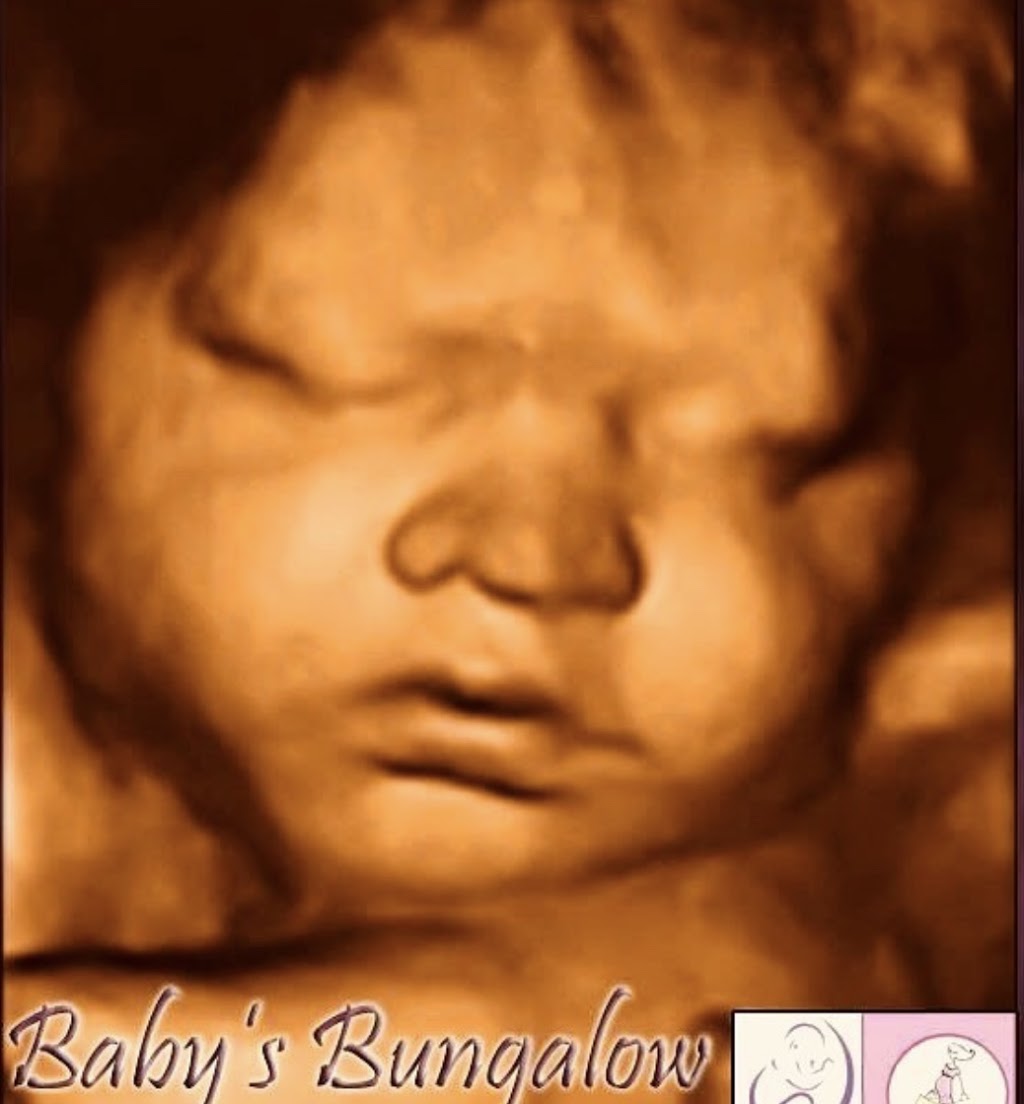 Babys Bungalow 3D & 4D Ultrasound Buffalo NY | 7293 Schultz Rd #1, North Tonawanda, NY 14120, USA | Phone: (716) 692-3343