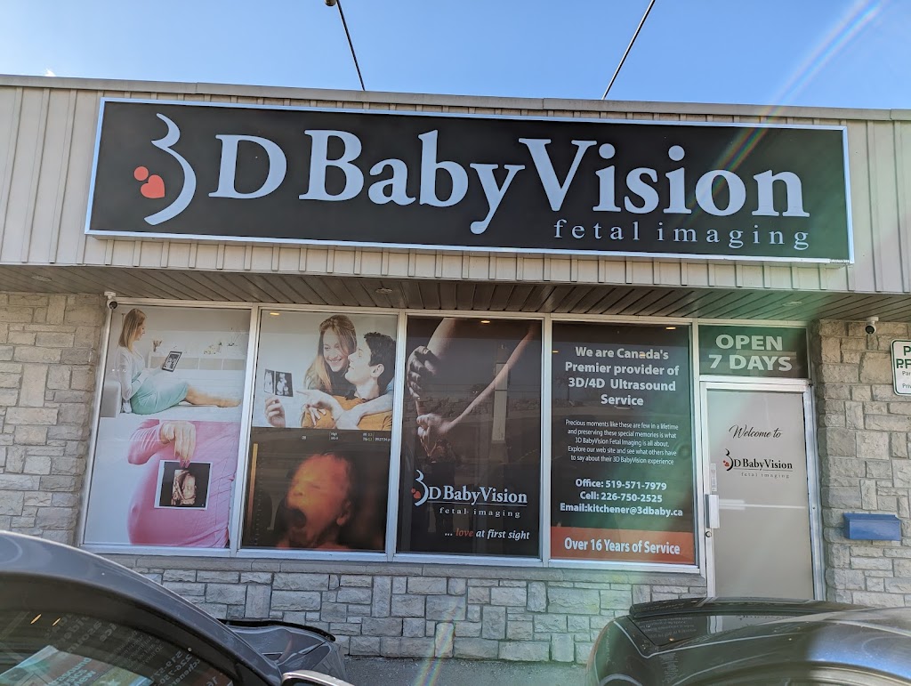 3D BabyVision Kitchener | 591 Lancaster St W, Kitchener, ON N2K 1M5, Canada | Phone: (519) 571-7979