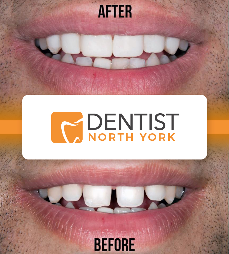 Dentist North York | 1800 Sheppard Ave E Suite 1042, North York, ON M2J 5A7, Canada | Phone: (416) 494-3868