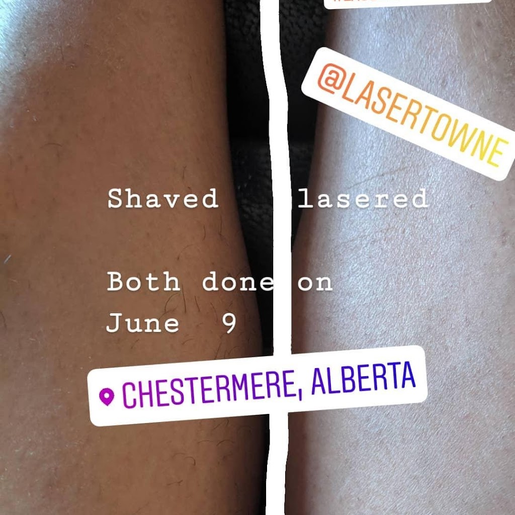 Laser Towne | 204 W Creek Cir, Chestermere, AB T1X 1R6, Canada | Phone: (587) 439-2967