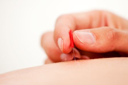 Elmira Olson Acupuncture (Summerside) | 104-1103 95 St SW, Edmonton, AB T6X 0P8, Canada | Phone: (780) 395-9170