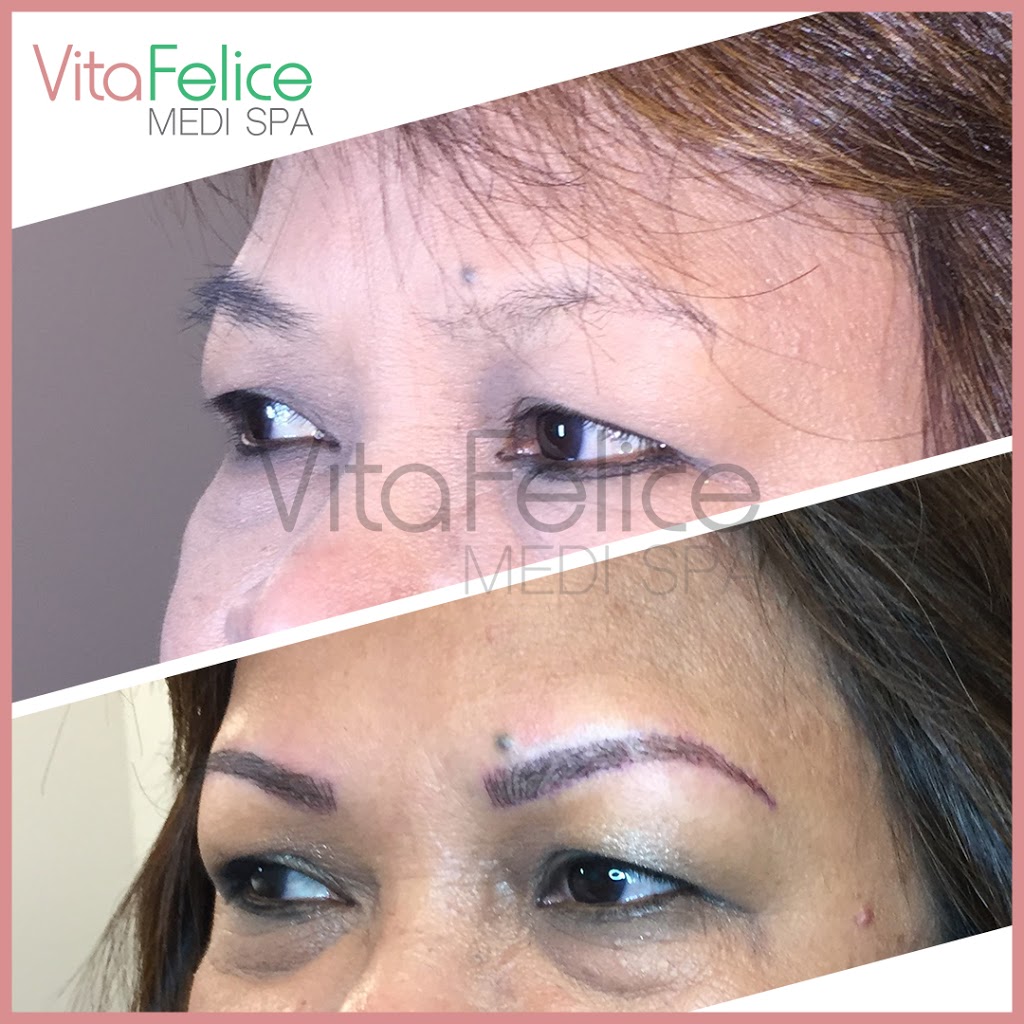 Vita Felice Medi Spa | 661 Columbia St, Unit 103, New Westminster, BC V3M 1A8, Canada | Phone: (778) 987-5480