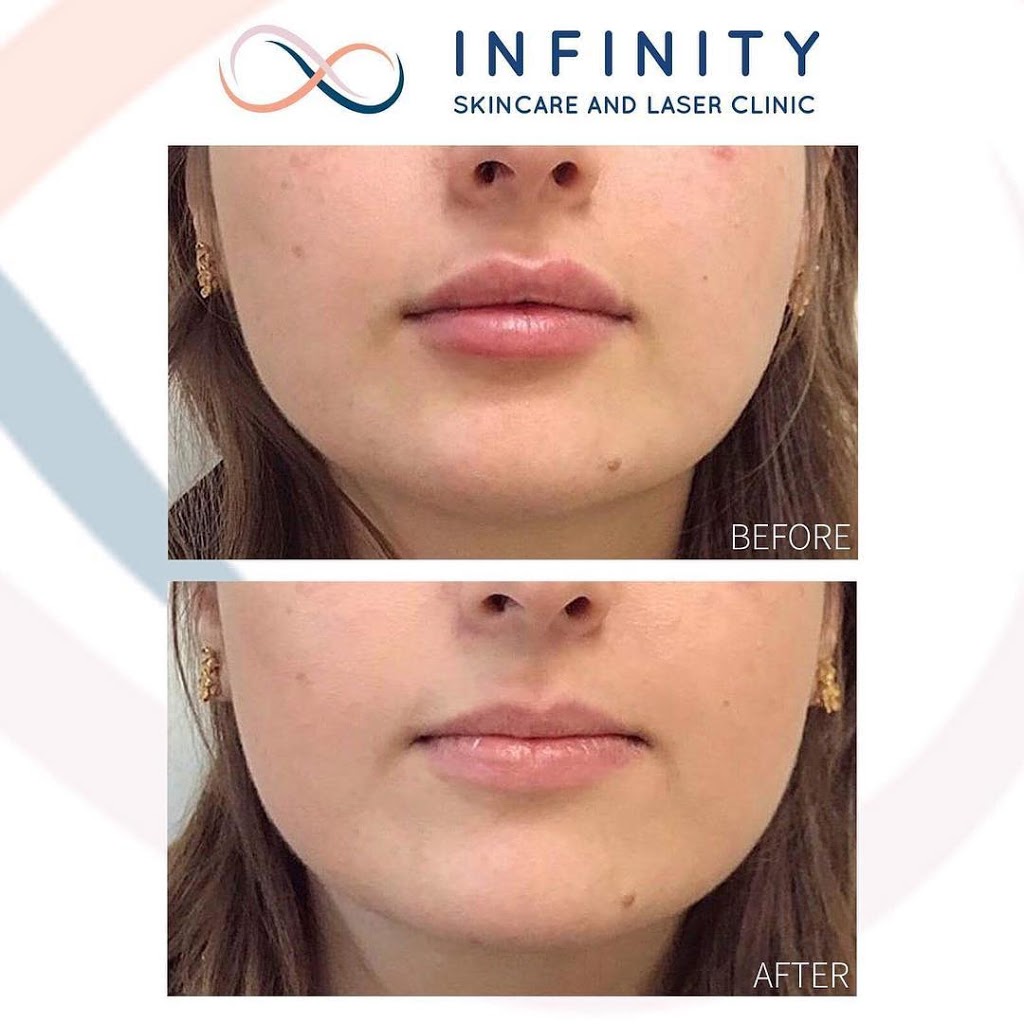 Infinity Skincare & Laser Clinic | 3175 Rutherford Rd unit 6, Concord, ON L4K 5Y6, Canada | Phone: (905) 883-6812