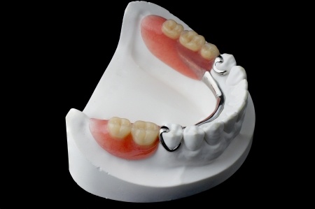 Esquimalt Denture Clinic | 1211 Esquimalt Rd, Victoria, BC V9A 3P1, Canada | Phone: (250) 361-3055