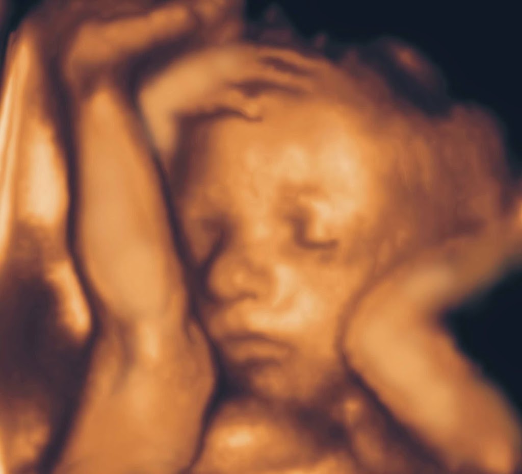 UC Baby 3D Ultrasound | 25 Watline Ave #21, Mississauga, ON L4Z 2Z1, Canada | Phone: (905) 615-0173