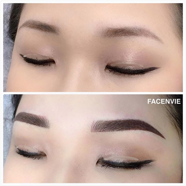 Facenvie Beauty Studio | 8339 Kennedy Rd #2702, Markham, ON L3R 5T5, Canada | Phone: (647) 879-5053