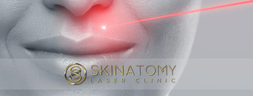 Skinatomy Laser Clinic | 2445 Yonge St, Toronto, ON M4P 1Y5, Canada | Phone: (416) 901-9392